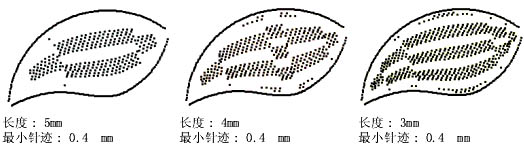 如何用自動(dòng)分割針跡來分割長針跡